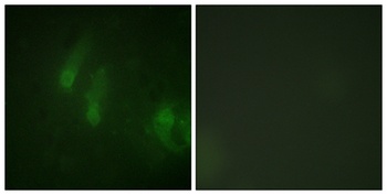 FANCA (phospho Ser1149) rabbit pAb