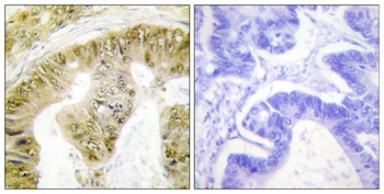 FANCA (phospho Ser1149) rabbit pAb