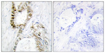 FANCA rabbit pAb Antibody