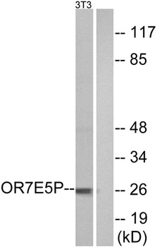 Olfactory receptor 7E5P rabbit pAb Antibody