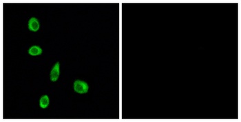 Olfactory receptor 8J1 rabbit pAb Antibody