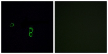 Olfactory receptor 9Q1 rabbit pAb Antibody