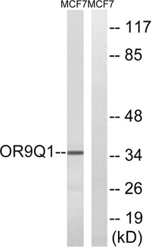 Olfactory receptor 9Q1 rabbit pAb Antibody