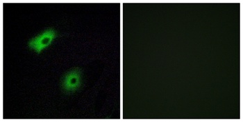Olfactory receptor 5A2 rabbit pAb Antibody