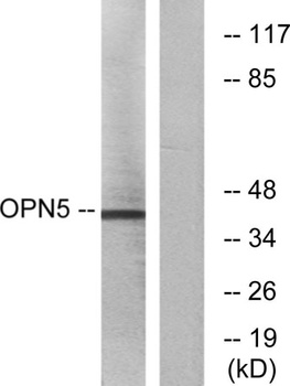 Neuropsin rabbit pAb Antibody