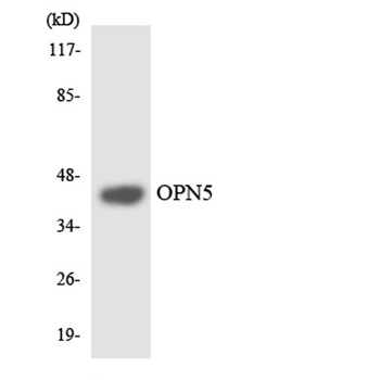Neuropsin rabbit pAb Antibody