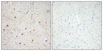 FGF-1 rabbit pAb Antibody