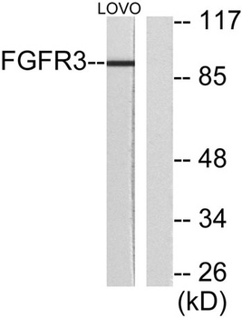FGFR-3 rabbit pAb Antibody