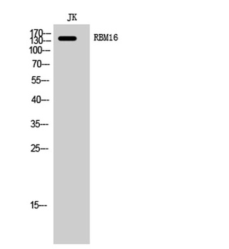 RBM16 rabbit pAb Antibody