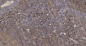 RBM16 rabbit pAb Antibody