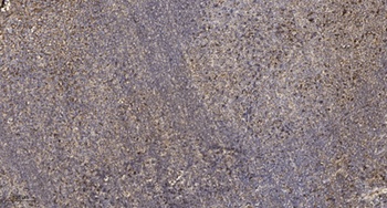 Raly rabbit pAb Antibody