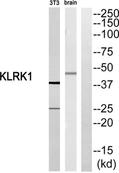 CD314 rabbit pAb Antibody
