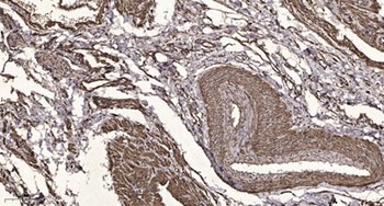 SIRT2 rabbit pAb Antibody