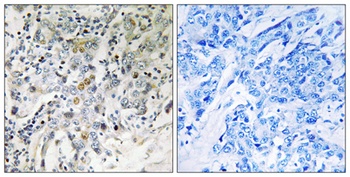ELL2 rabbit pAb Antibody