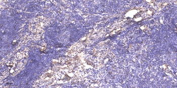 Shank 2 rabbit pAb Antibody