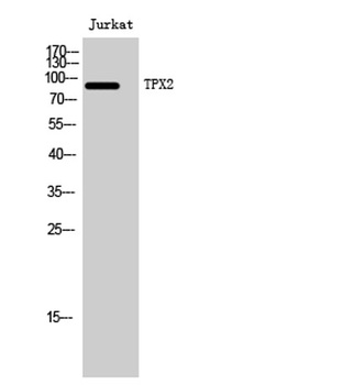 TPX2 rabbit pAb Antibody