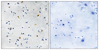 TPX2 rabbit pAb Antibody