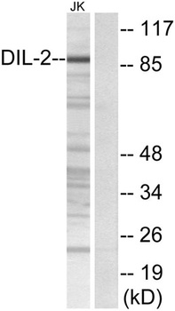 TPX2 rabbit pAb Antibody