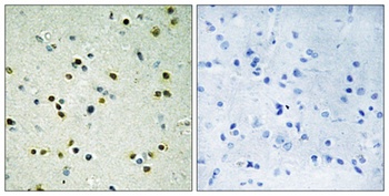 JMJD2B rabbit pAb Antibody
