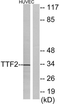 FoxE1 rabbit pAb Antibody