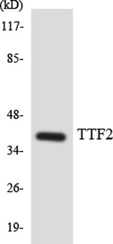 FoxE1 rabbit pAb Antibody
