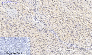 FoxO1 rabbit pAb Antibody