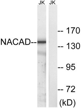 NACAD rabbit pAb Antibody