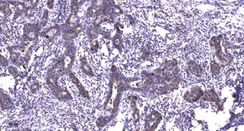 NACAD rabbit pAb Antibody