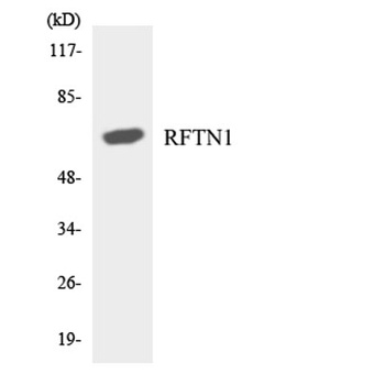 Raftlin rabbit pAb Antibody