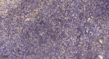 Raftlin rabbit pAb Antibody