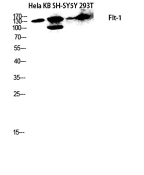 Flt-1 rabbit pAb Antibody