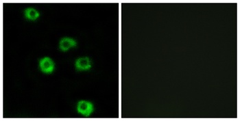 Latrophilin-2 rabbit pAb Antibody