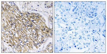 Latrophilin-2 rabbit pAb Antibody