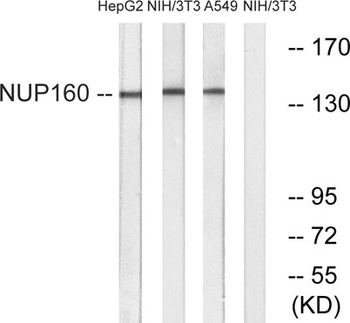Nup160 rabbit pAb Antibody