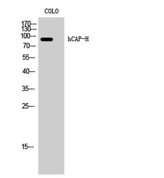 hCAP-H rabbit pAb Antibody