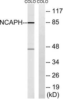 hCAP-H rabbit pAb Antibody