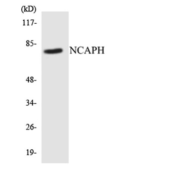 hCAP-H rabbit pAb Antibody
