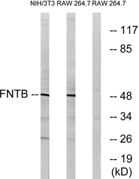 FTβ rabbit pAb Antibody