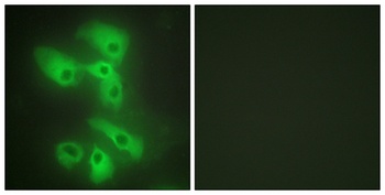 JIP-2 rabbit pAb Antibody