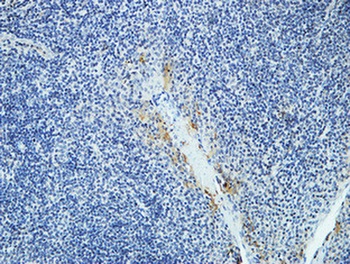 DAPK2 rabbit pAb Antibody