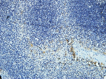 DAPK2 rabbit pAb Antibody