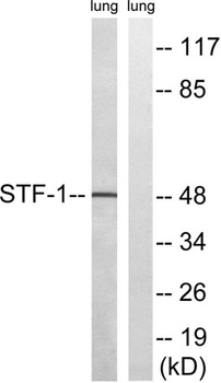 SF-1 rabbit pAb Antibody