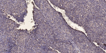 SF-1 rabbit pAb Antibody