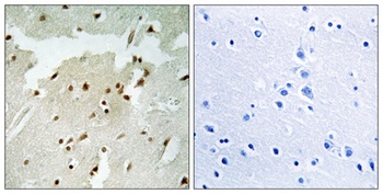 Ku-70 (phospho Ser5) rabbit pAb