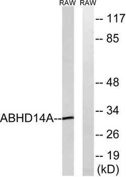 ABHD14A rabbit pAb Antibody