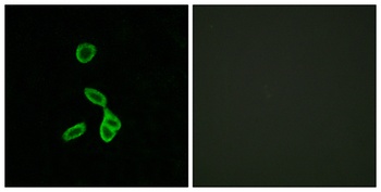 GALR1 rabbit pAb Antibody