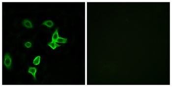 KANK2 rabbit pAb Antibody