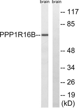 TIMAP rabbit pAb Antibody
