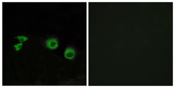 MIP-T3 rabbit pAb Antibody