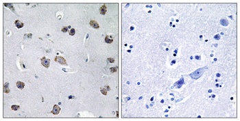 MIP-T3 rabbit pAb Antibody
